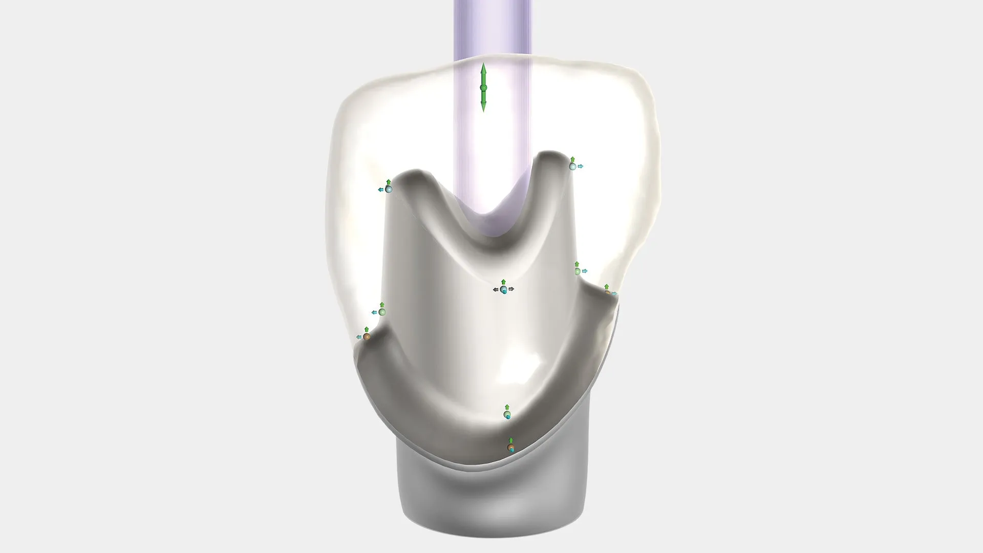 exocad - Chairside CAD Implant Module